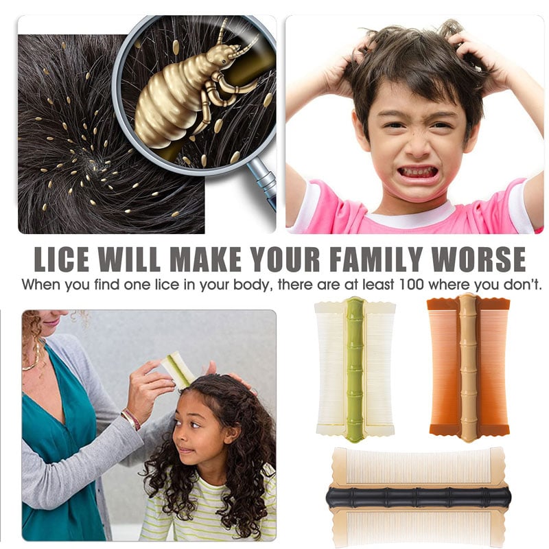 Lice Comb (Fast Removal of Lice Eggs, Nits and Dandruff) (PACK OF 3)